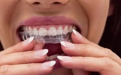 Invisalign Thousand Oaks: Clear Aligner Therapy for Discreet Orthodontic Correction